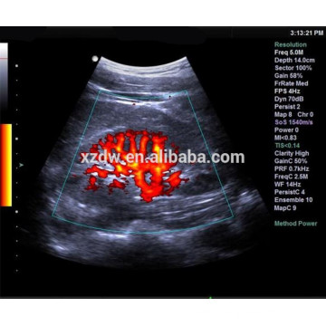 Machine d&#39;échographie de Doppler de couleur de 4D pour la grossesse et l&#39;échocardiographie 4D et la machine d&#39;écho d&#39;Ecografo pour le coeur et le navire